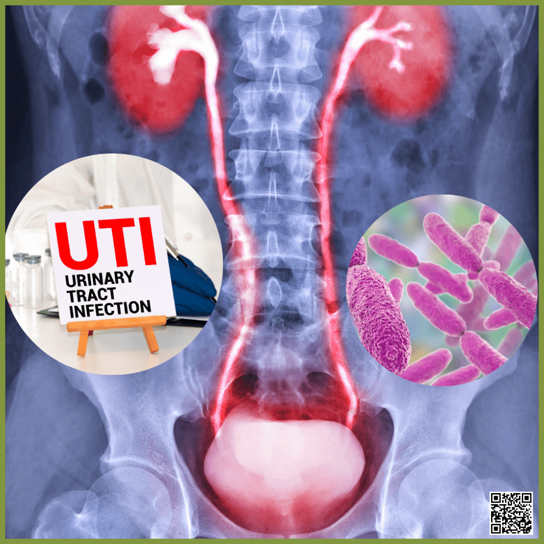 Image of the urinary tract and UTI bacteria that cranberries can help prevent and relieve symptoms.